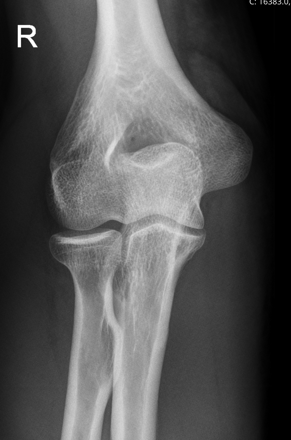 Bildgebende Verfahren (Röntgen, CT, Nuklearmagnetresonanz, PET, Ultraschall)